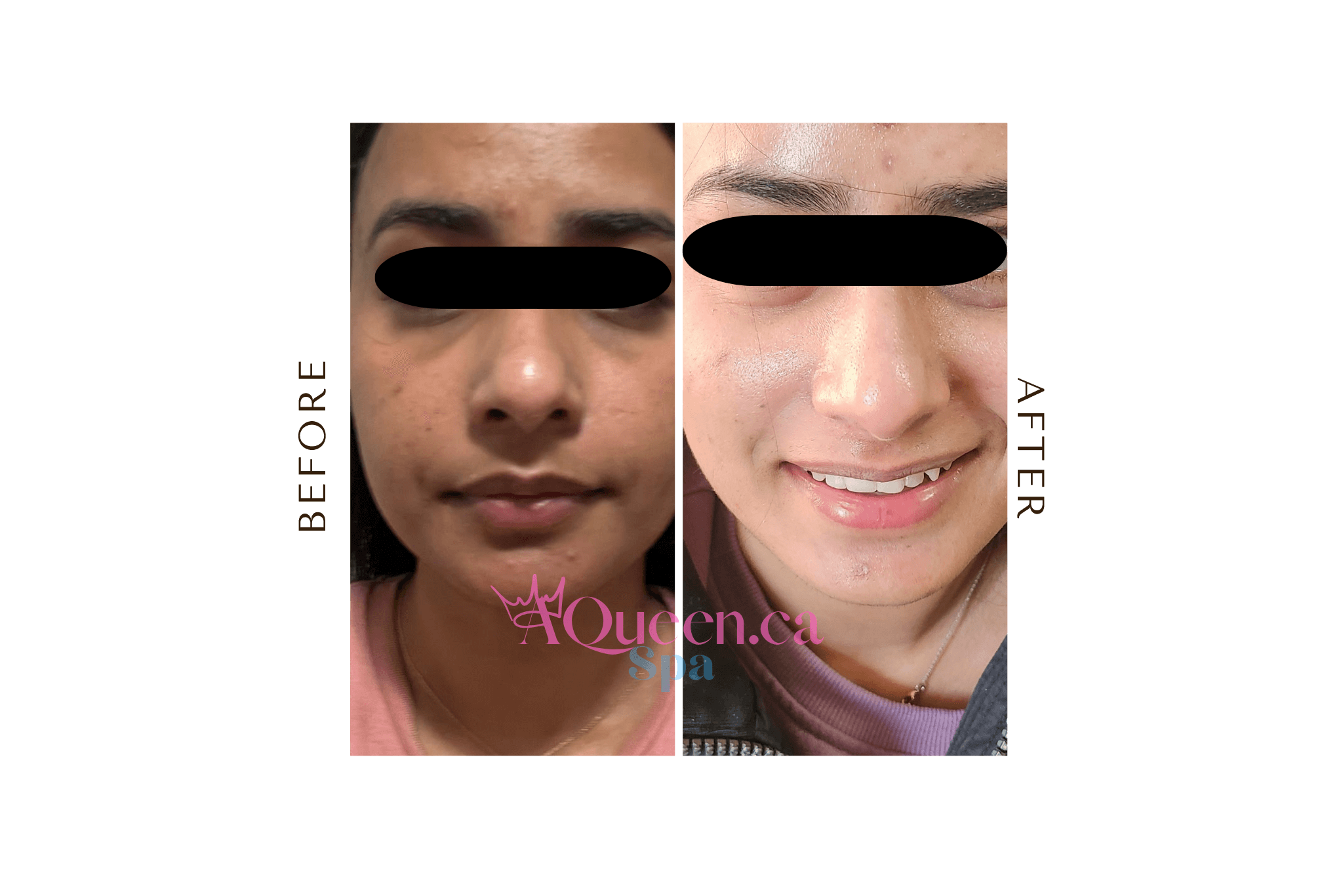 AQueen Spa review image in Brampton 1 duplicate