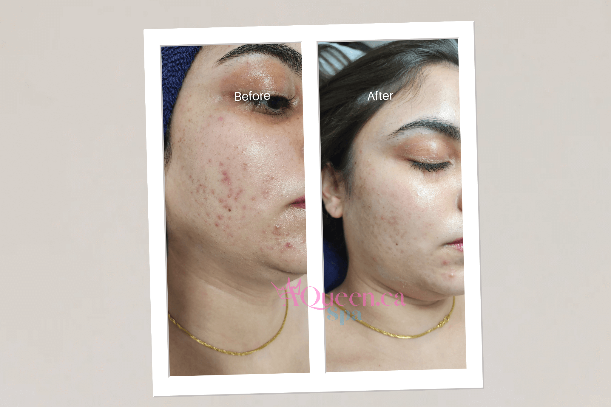 AQueen Spa review image in Brampton 3