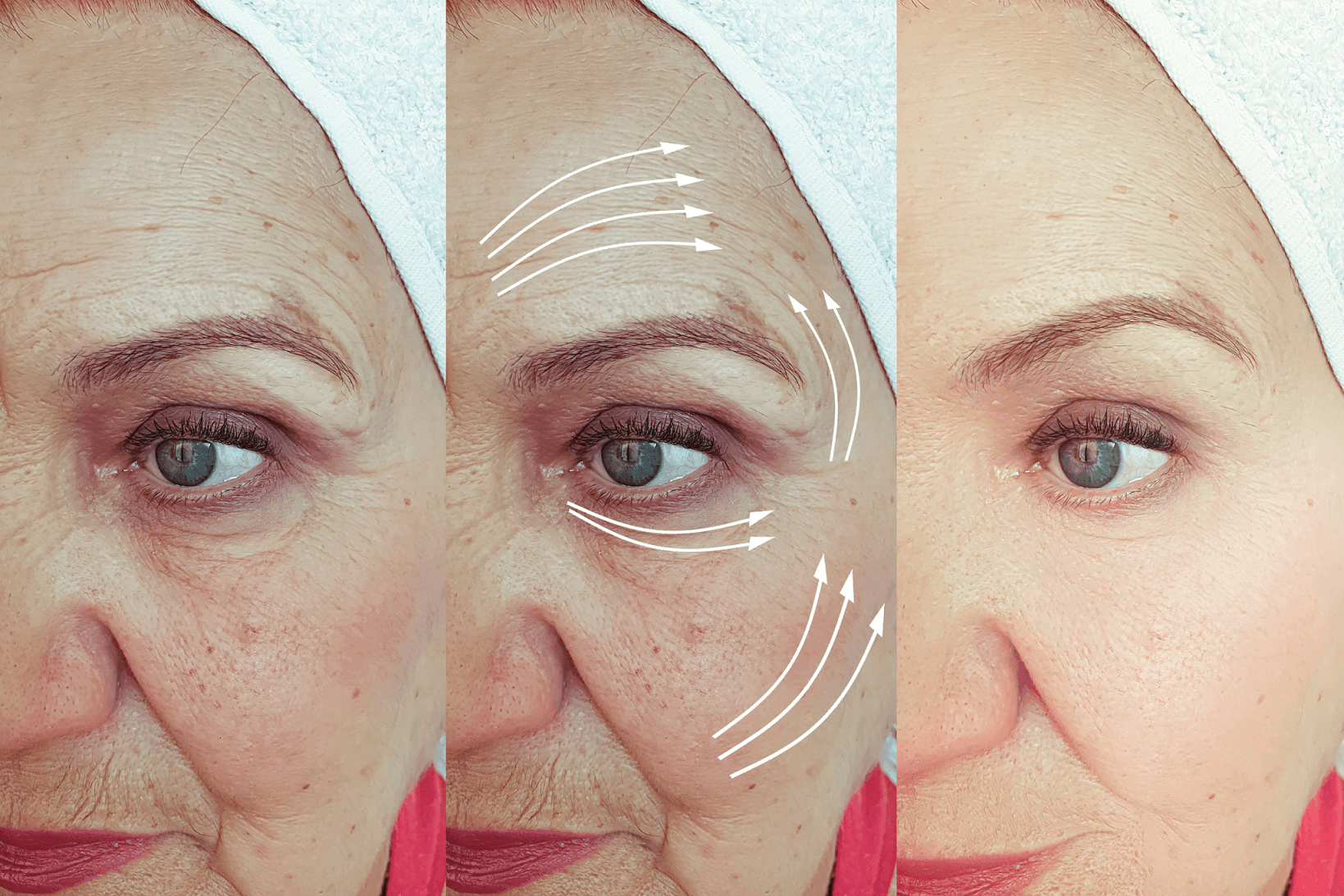 Anti-Aging Facial at AQueen Spa